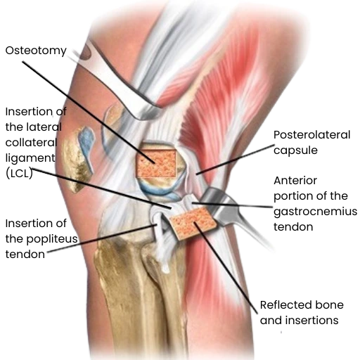 Anatomical diagram showing key joint-support ingredients and their areas of action on knee structure